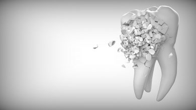Implant dentar București